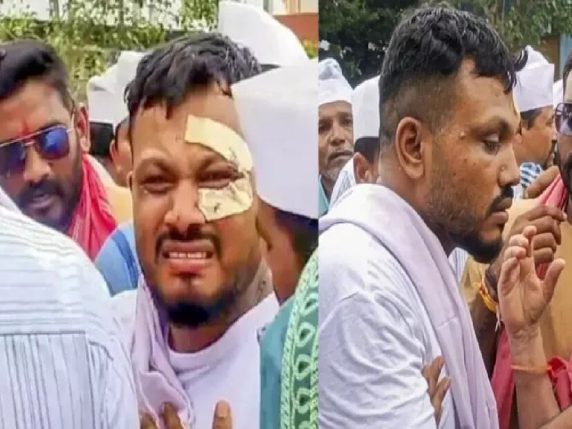 সেই অভিশপ্ত বিমানের একমাত্র জীবিত যাত্রী বিশ্বাস কুমার রমেশ এখনও ঘোরের মধ্যে রয়েছেন। কারও সঙ্গে কথা বলছেন না। এমনকী, তাঁকে স্বাভাবিক করে তুলতে পরিবারের লোকজন মনোবিদের পরামর্শও নিতে শুরু করেছেন। সংবাদ সংস্থা পিটিআইকে এ কথা জানিয়েছেন রমেশের আত্মীয়েরা।