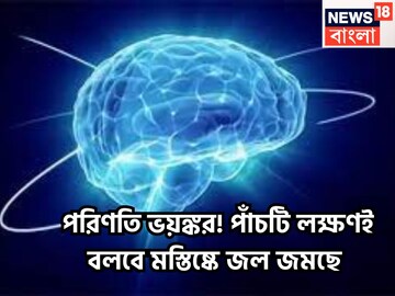 পরিণতি ভয়ঙ্কর! পাঁচটি লক্ষণই বলবে মস্তিষ্কে জল জমছে, সঠিক সময়ে সতর্ক না হলেই স্তব্ধ পরিণতি ভয়ঙ্কর! পাঁচটি লক্ষণই বলবে মস্তিষ্কে জল জমছে, সঠিক সময়ে সতর্ক না হলেই স্তব্ধ