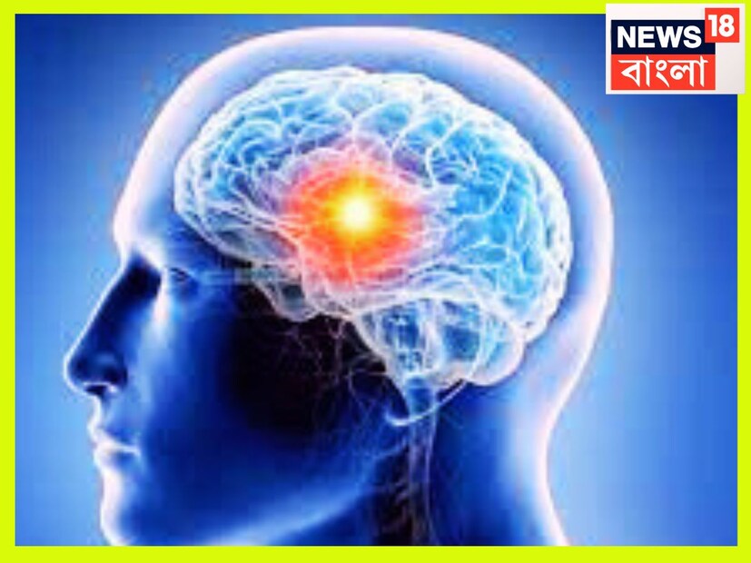 ব্রেনে রক্ত সংবহণ করার ক্ষেত্রে সমস্যা হতে পারে ৷ এই সমস্যা এড়িয়ে গেলে প্রচন্ড চাপ বাড়তে পারে ৷ প্রতীকী ছবি ৷