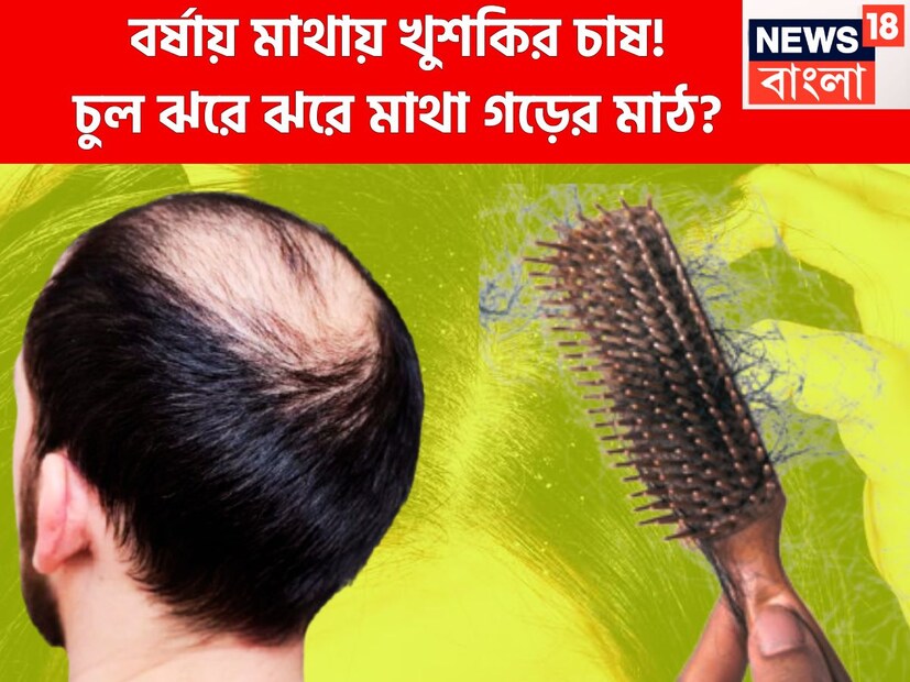বৃষ্টিপাতের ফলে ঠান্ডা ঠান্ডা পরিবেশ যেখানে মনকে শান্তি দেয় কিন্তু আবহাওয়ার এই পরিবর্তন চুলের স্বাস্থ্যের জন্য অত্যন্ত গুরুত্বপূর্ণ হতে পারে ৷ প্রতীকী ছবি ৷ 