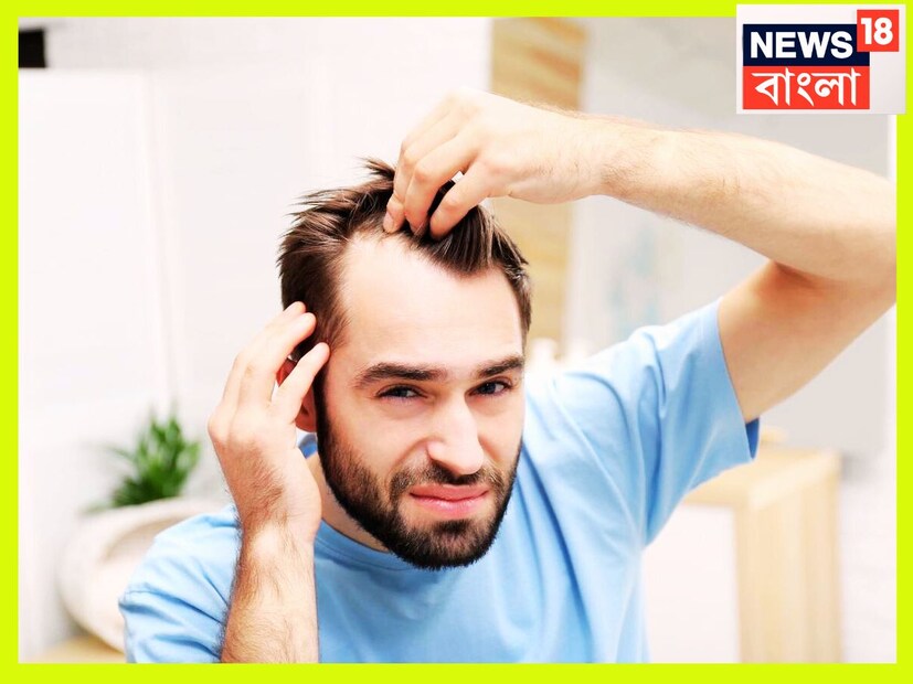বর্ষাকালে কোনও ভাবেই চুল ভেজা রাখা যাবেনা ৷ অনেকেরই স্বভাব আছে ৷ দীর্ঘ সময় ধরে চুল ভেজা রাখলে ছত্রাক জনিত সমস্যা হতে পারে, সঙ্গে হতে খুশকিও ৷ সেই দিকেও খেয়াল রাখতে হবে ৷ প্রতীকী ছবি ৷
