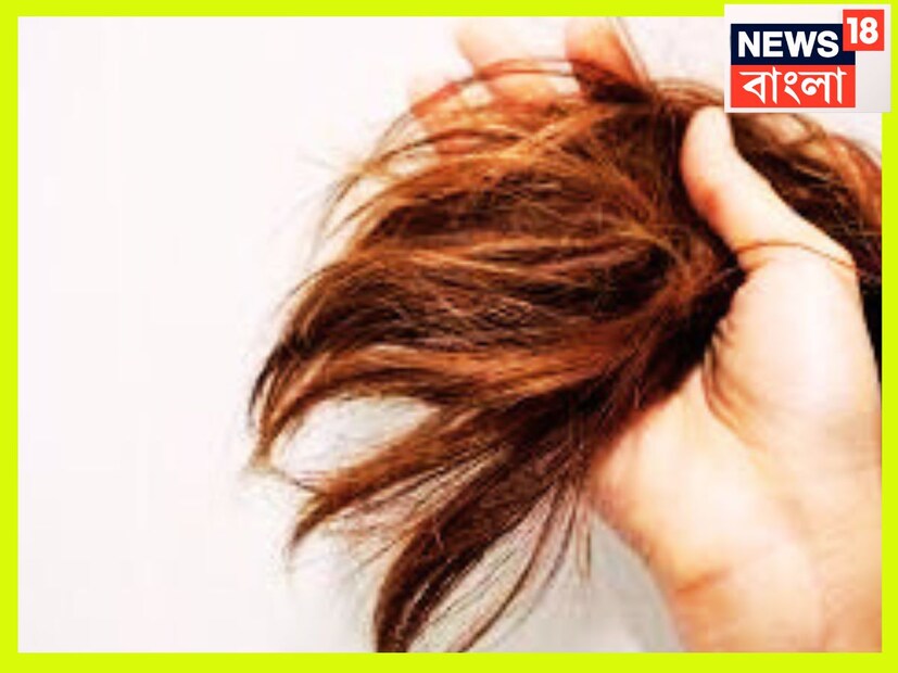 চুলের গোড়া পরিষ্কার অভিযান, সপ্তাহে কমপক্ষে ২বার শ্যাম্পু দিয়ে চুলের গোড়া পরিষ্কার করতে হবে ৷ যাতে ধুলো, রোগ জীবাণু, ঘাম চুলের গোড়ায় না জমতে পারে ৷ প্রতীকী ছবি ৷