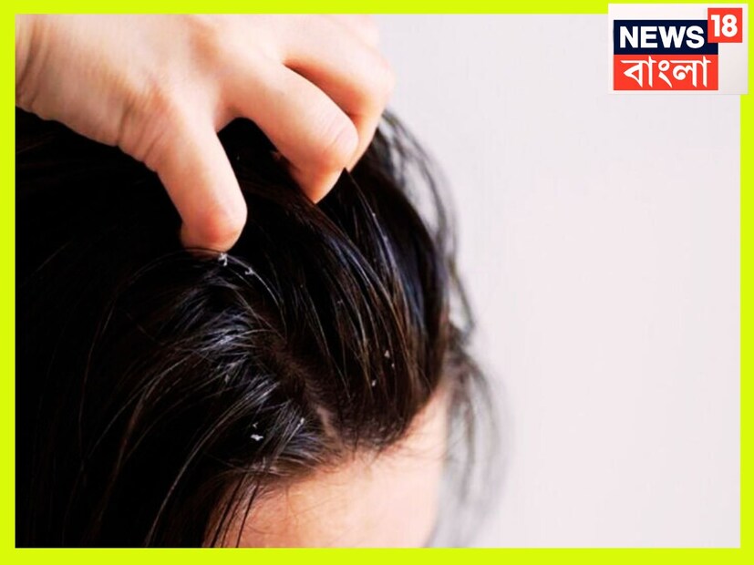 এই ভাবে চুল ধুলেই প্রাকৃতিক ভাবে চুলের স্বাস্থ্য ভাল হয়ে থাকে ৷ আলাদা জেল্লা তৈরি হয়ে থাকে চুলের ৷ প্রতীকী ছবি ৷