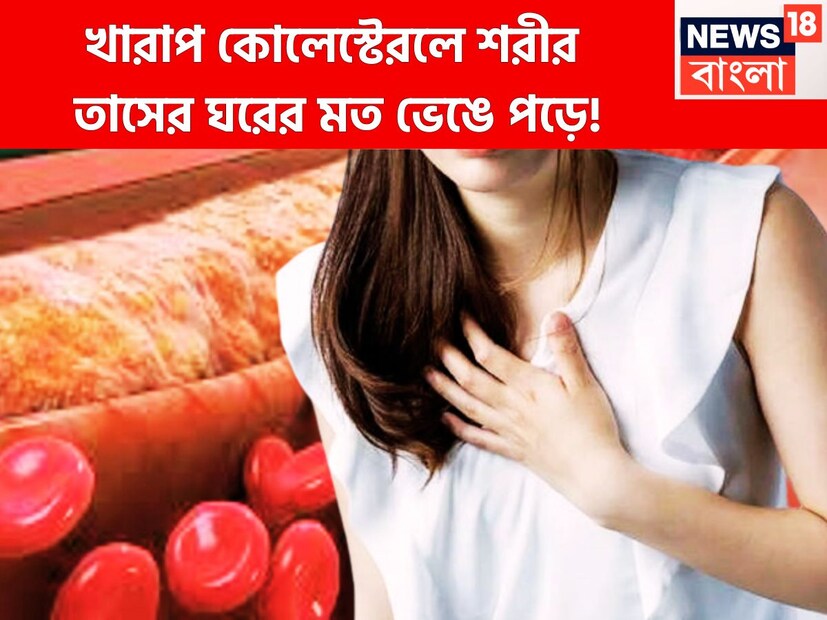 মানুষের শারীরিক বিভিন্ন ধরনের কার্যকলাপের জন্য কোলেস্টেরল অত্যন্ত গুরুত্বপূর্ণ হয়ে ওঠে ৷ শরীরে খারাপ কোলেস্টেরল বাড়তে শুরু করলে হার্টের ক্ষেত্রে অত্যন্ত ঝুঁকিপূর্ণ হতে পারে ৷ প্রতীকী ছবি ৷