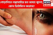 Viral GK: গোড়ালিতে লঙ্কাবাটার মত জ্বালাপোড়া! কোন ভিটামিনের অভাবে এমন হয়?