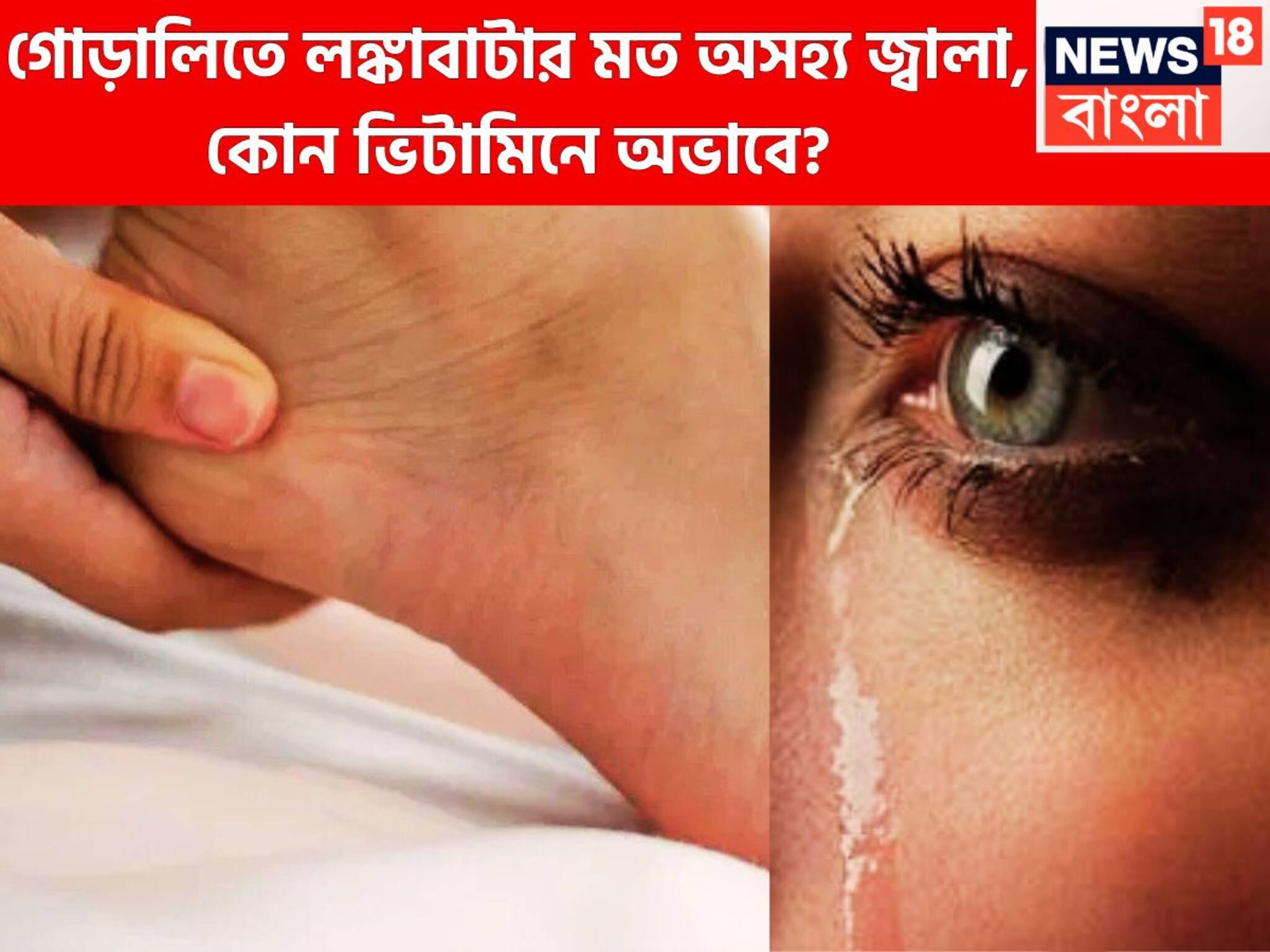 Viral GK: গোড়ালিতে লঙ্কাবাটার মত জ্বালাপোড়া! কোন ভিটামিনের অভাবে এমন হয়? উত্তর জানা নেই অনেকেরই