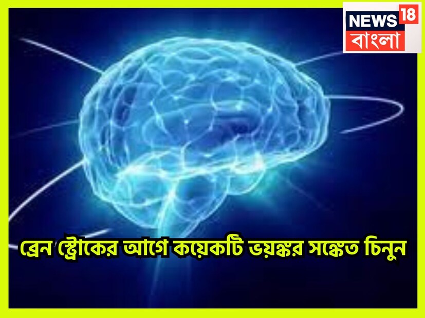 অনেক হঠাৎ করে কথাবার্তাতে সমস্যা, মাথা ঘোরানো, চোখ মুখ শুকনো শুকনো ভাব, ভীষণ ভাবে ক্লান্তিই বড়সড় রোগের ইঙ্গিতও হতে পারে ৷ প্রতীকী ছবি ৷