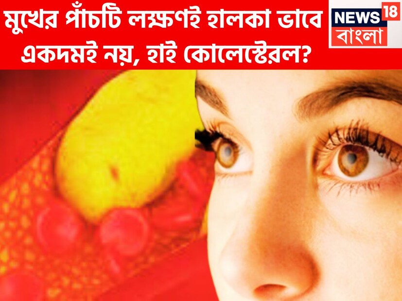 হাই কোলেস্টেরলকেই বলা হয়ে থাকে সাইলেন্ট কিলার, কিন্তু এর লক্ষণ সহজে বুঝতে পারা যায়না তবে ৷ যখন এর লক্ষণ শরীরে পড়ে ঠিক তখন অনেক দেরি হয়ে যায় ৷ প্রতীকী ছবি ৷