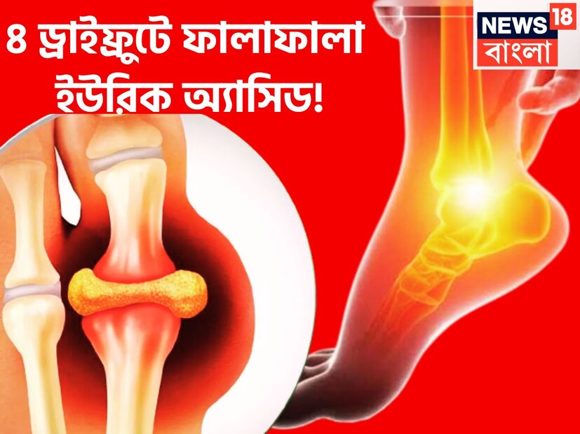 শরীরের খারাপ পদার্থ বর্জ্র্য পদার্থ কিডনি ফিল্টার করে বাইরে বের করে দেয় ৷ হজমের পর শরীর থেকে পিউরিন নিঃসৃত হয়ে থাকে ৷ প্রতীকী ছবি ৷