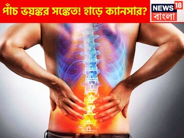 হাড়ে অসহ্য ব্যথা যন্ত্রণা! হালকা ভাবে নিলেই ক্যানসারের খাঁড়া, পাঁচ ভয়ঙ্কর সঙ্কেত