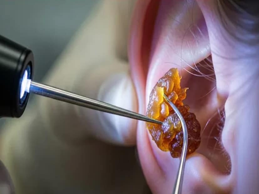 Tips To Remove Earwax: কানে অতিরিক্ত ময়লা জমেছে? চিন্তা নেই, ঘরে বসে নিমেষেই দূর হবে সমস্যা, রইল কান সাফ রাখার সহজ কিছু টিপস Tips To Remove Earwax: কানে অতিরিক্ত ময়লা জমেছে? চিন্তা নেই, ঘরে বসে নিমেষেই দূর হবে সমস্যা, রইল কান সাফ রাখার সহজ কিছু টিপস