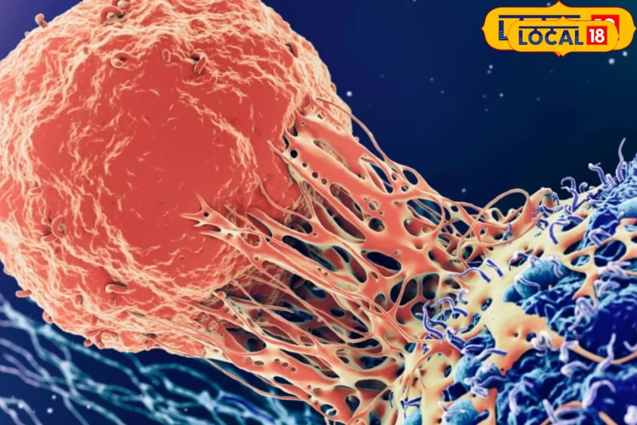 ক্যানসারের ঝুঁকি অনেকগুণ কমাবে,কোনও শাক-পাতা-সবজি নয়,দামি ওষুধও নয়,নিয়মিত করুন এই কাজ