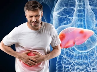 লিভারে ফ্যাট! রক্ত ​​পরীক্ষা ছাড়াই কীভাবে জানবেন ফ্যাটি লিভার হয়েছে, জানালেন বিশেষজ্ঞ