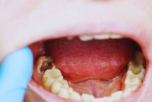 Bad Breath: মুখে বিকট দুর্গন্ধ! দাঁতের গোড়ায় কালো গর্ত? ঘরোয়া টোটকাতেই ব্যথা গায়েব, হলদেটে দাঁত হবে ঝকঝকে সাদা