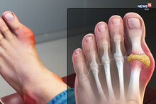 শীতে যেন আরও পীড়া দেয়! ধনে পাতা- সহ তিন পাতাকে বলা হয় আথ্রাইটিসের ওষুধ ...