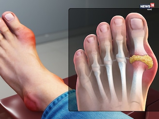 শীতে যেন আরও পীড়া দেয়! ধনে পাতা- সহ তিন পাতাকে বলা হয় আথ্রাইটিসের ওষুধ ...