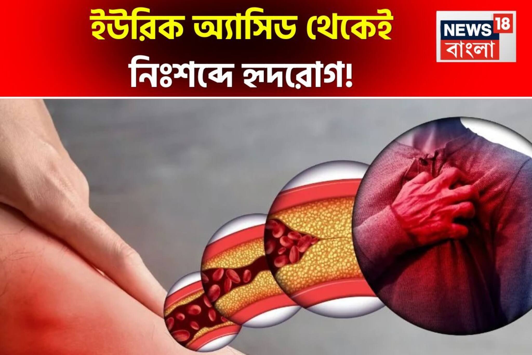 ইউরিক অ্যাসিড থেকে নিঃশব্দে হৃদরোগ! এই ২ টক জিনিস, ১ বীজে ইউরিক অ্যাসিড কমান, হার্ট বাঁচান