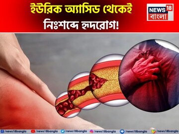 ইউরিক অ্যাসিড থেকে নিঃশব্দে হৃদরোগ! এই ২ টক জিনিস, ১ বীজে ইউরিক অ্যাসিড কমান, হার্ট বাঁচান