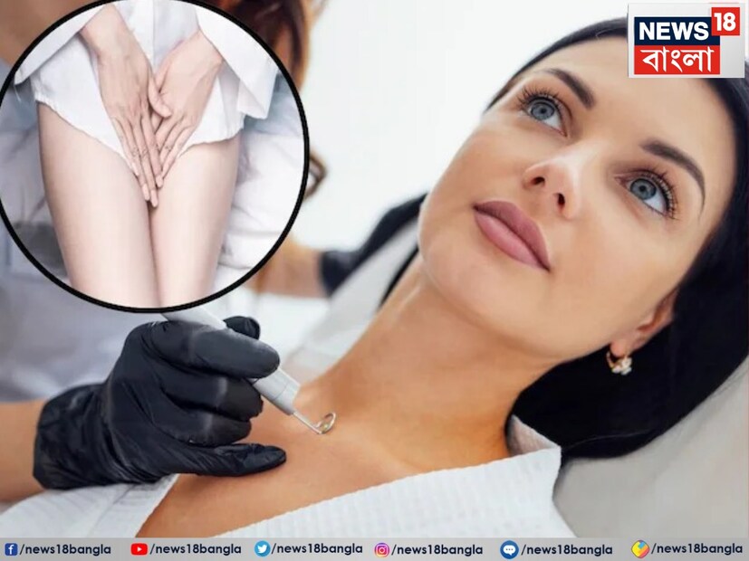  তিল প্রত্যেকের জীবনের সঙ্গে সম্পর্কিত এবং যা কিনা অনেক ইঙ্গিত দেয়। তাই কিছু জায়গায় তিলকে শুভ এবং কিছু জায়গায় অশুভ বলে মনে করা হয়। শুধু তাই নয়, জ্যোতিষশাস্ত্রে, তিলগুলির মাধ্যমেও একজন ব্যক্তির ব্যক্তিত্ব সনাক্ত করা যায়। 