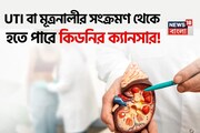 UTI বা মূত্রনালীর সংক্রমণ থেকে হতে পারে কিডনির ক্যানসার! মহিলারা সতর্ক না হলে শিয়রে শমন!