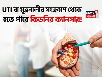 UTI বা মূত্রনালীর সংক্রমণ থেকে হতে পারে কিডনির ক্যানসার! মহিলারা সতর্ক না হলে শিয়রে শমন! UTI বা মূত্রনালীর সংক্রমণ থেকে হতে পারে কিডনির ক্যানসার! মহিলারা সতর্ক না হলে শিয়রে শমন!