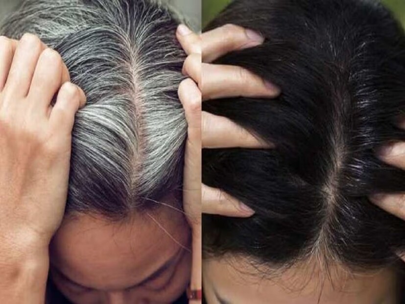 (Disclaimer: এই প্রতিবেদনটি কেবলমাত্র সাধারণ তথ্যের জন্য, তাই বিস্তারিত জানতে হলে সর্বদা বিশেষজ্ঞের পরামর্শ নিন।) (সব ছবি-নেটমাধ্যম)