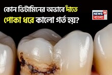 কোন ভিটামিনের অভাবে দাঁতে পোকা ধরে কালো গর্ত হয়? চোখে জল আসে ভাঙা দাঁতের যন্ত্রণায়? জানুন