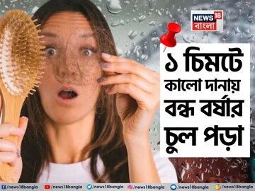 মুঠো মুঠো চুল উঠছে? শুকনো আদার সঙ্গে এই কালো দানা খান জাস্ট ১ চিমটে! কমবে দলা দলা চুল পড়া মুঠো মুঠো চুল উঠছে? শুকনো আদার সঙ্গে এই কালো দানা খান জাস্ট ১ চিমটে! কমবে দলা দলা চুল পড়া
