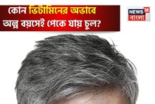 কোন ভিটামিনের অভাবে অল্প বয়সেই সাদা হয়ে যায় মাথার কালো চুল? রোজ কী খেলে পাকবে না চুল?