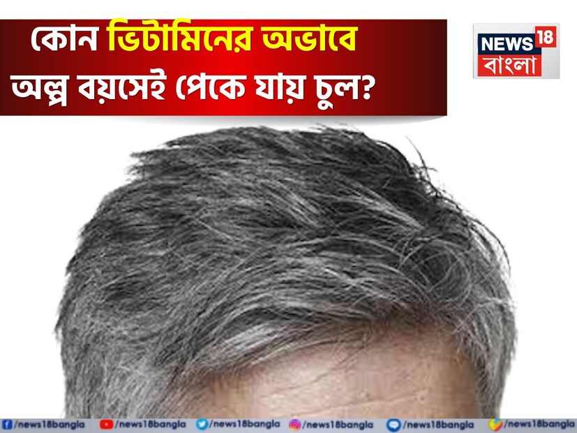 আজকাল তরুণদের চুল দ্রুত সাদা হয়ে যাচ্ছে। আগে ৫০-৬০ বছর বয়সের পর মানুষের চুল সাদা হতে শুরু করত, কিন্তু এখন ২০ থেকে ৩০ বছর বয়সে মানুষের চুল সাদা হয়ে যাচ্ছে। অতিরিক্ত মানসিক চাপ, দূষণ, জেনেটিক্স, খারাপ খাদ্যাভ্যাস এবং ঘুমের অভাবের মতো অনেক কারণ চুল সাদা হওয়ার জন্য দায়ী। তবে শরীরে কিছু ভিটামিনের অভাবও তরুণদের চুল সাদা হতে পারে। এই বিষয়ে সকলের গুরুত্বপূর্ণ বিষয়গুলি জানা উচিত।