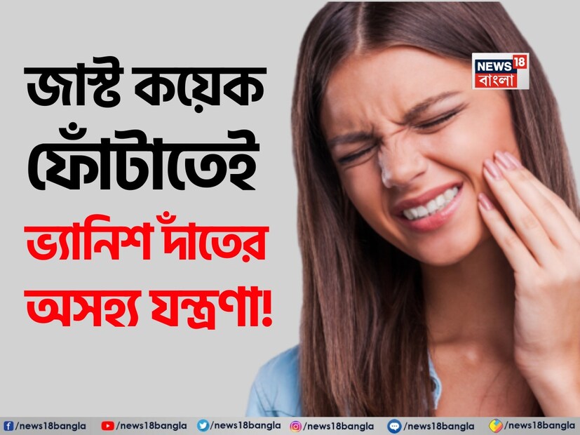 আজকাল, পরিবর্তিত জীবনধারা এবং খাদ্যাভ্যাস সরাসরি আমাদের দাঁতের স্বাস্থ্যের উপর প্রভাব ফেলছে। অতিরিক্ত জাঙ্ক ফুড, কোল্ড ড্রিঙ্কস এবং মিষ্টির কারণে দাঁত দুর্বল হয়ে পড়ছে, যার কারণে ব্যথা, গহ্বর, ফোলাভাব এবং মাড়ির সমস্যা সাধারণ হয়ে উঠছে। কখনও কখনও এই ব্যথা এতটাই অসহনীয় হয়ে ওঠে যে মানুষ তাৎক্ষণিকভাবে ডাক্তারের কাছে ছুটে যায়। কিন্তু আপনি কি জানেন যে দাঁতের ব্যথা থেকে মুক্তি পেতে আপনার বাড়িতেই একটি কার্যকর ঘরোয়া প্রতিকার রয়েছে?
