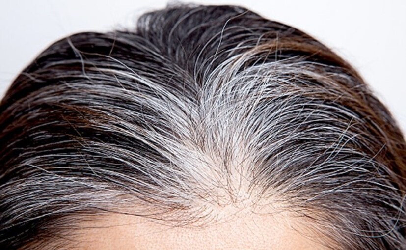 Disclaimer: এই প্রতিবেদনটি কেবলমাত্র সাধারণ তথ্যের জন্য, তাই বিস্তারিত জানতে হলে সর্বদা বিশেষজ্ঞের পরামর্শ নিন। (সব ছবি-নেটমাধ্যম)