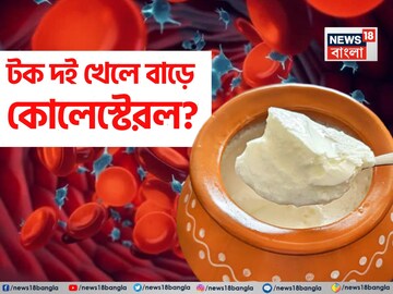 খারাপ কোলেস্টেরল বেড়ে যায় টক দই খেলে? কোলেস্টেরল থাকলে দই খাবেন? বড় ক্ষতি এড়াতে জানুন