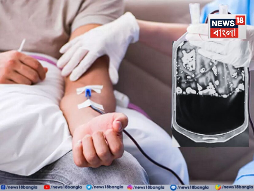 *সম্প্রতি, আমাদের দেশে ব্লাড ক্যানসারে আক্রান্তের সংখ্যা তীব্রভাবে বৃদ্ধি পেয়েছে। ব্লাড ক্যানসার একটি বিপজ্জনক রোগ যা রক্ত, অস্থি মজ্জা বা লিম্ফ সিস্টেমে শুরু হয়। এটি রক্ত কোষের কার্যকারিতা সম্পূর্ণরূপে ব্যাহত করে। দেরিতে রোগ শনাক্ত হলে চিকিৎসা খুব কঠিন হয়ে যায়। অনেকক্ষেত্রে রোগীর যুদ্ধ করার মতো অবস্থাই থাকে না। চিকিৎসা শুরু হওয়ার প্রায় সঙ্গে সঙ্গেই মৃত্যু হয় অনেকের। সংগৃহীত ছবি। 