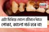 গোল্লায় যাক দামি টুথপেস্ট-মাউথওয়াশ! ‘এটা’ চিবোলেই জীবনে হবে না দাঁতে পোকা, কালো গর্ত!