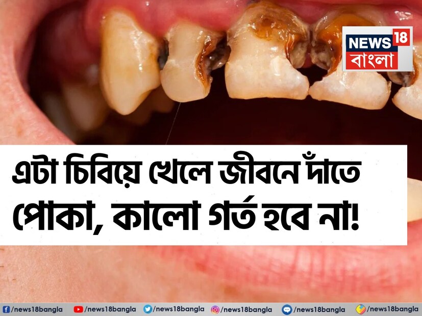 আমাদের হাসি আমাদের সৌন্দর্য বৃদ্ধি করে। কিন্তু কখনও কখনও এই সৌন্দর্য কেড়ে নেওয়া হয় এবং এর কারণ হল আমাদের দাঁতের গহ্বর। যার কারণে দাঁতে ব্যথা হয় এবং কখনও কখনও দাঁতের চিকিৎসার জন্য দাঁত অপসারণ করতে হতে পারে। এমন পরিস্থিতিতে মনে প্রশ্ন জাগে যে দাঁত ক্ষয় থেকে বাঁচাতে কী করা উচিত যাতে এমন সমস্যার সম্মুখীন না হতে হয়। 