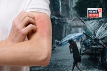 বর্ষায় সারা শরীরে দাদ, হাজা, চুলকানি? ঘরোয়া উপায়গুলিতে মাত্র ৭ দিনে হবে ভ্যানিশ