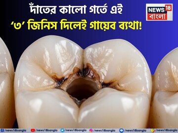 দাঁতের কালো গর্তে পুলটিশ দিন রান্নাঘরের এই ৩ জিনিস এক কুচি! নিমেষে কমবে চোখে জল আনা ব্যথা!