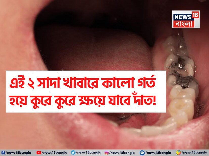 সব ধরনের খাবার আপনার দাঁতের জন্য উপযুক্ত নয়। কিছু খাবার স্বাভাবিকভাবেই আপনার এনামেলকে রক্ষা করতে পারে, আবার অন্যগুলো নীরবে দাগ এবং গর্ত তৈরি করতে পারে। আপনি যদি আপনার দাঁতকে সুস্থ রাখতে চান, তাহলে আপনার দাঁতের জন্য সবচেয়ে ভাল এবং খারাপ খাবারের কথা জেনে রাখা দরকার৷ দাঁত ভাল রাখার জন্য খুবই দরকার এটা৷ বলছেন পুষ্টিবিদ মনপ্রীত কালরা৷