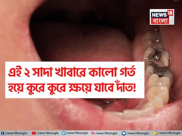 ভুলেও মুখে দেবেন না এই ২ সাদা খাবার! কালো গর্ত হয়ে কুরে কুরে ক্ষয়ে যাবে দাঁত! আজই বাদ দিন ভুলেও মুখে দেবেন না এই ২ সাদা খাবার! কালো গর্ত হয়ে কুরে কুরে ক্ষয়ে যাবে দাঁত! আজই বাদ দিন
