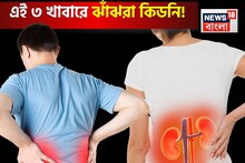 এই ৩ খাবারে ঝাঁঝরা কিডনি! অঙ্গ প্রত্যঙ্গে জমবে বিষাক্ত বর্জ্য! তিলে তিলে অকেজো শরীর