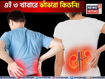 এই ৩ খাবারে ঝাঁঝরা কিডনি! অঙ্গ প্রত্যঙ্গে জমবে বিষাক্ত বর্জ্য! তিলে তিলে অকেজো শরীর