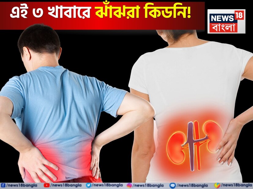 কিডনি আমাদের শরীরের একটি গুরুত্বপূর্ণ অঙ্গ, যা রক্ত পরিশোধন করে এবং প্রস্রাবের আকারে শরীর থেকে বিষাক্ত উপাদান এবং অতিরিক্ত জল অপসারণ করে৷ কিন্তু পরিবর্তিত জীবনধারা, অনিয়মিত খাদ্যাভ্যাস এবং ক্রমবর্ধমান রোগের কারণে কিডনির সমস্যা দ্রুত বৃদ্ধি পাচ্ছে। সময়মতো মনোযোগ না দিলে কিডনি ক্ষতিগ্রস্ত হতে পারে, যার ফলে ডায়ালাইসিস বা প্রতিস্থাপনের প্রয়োজন হতে পারে।