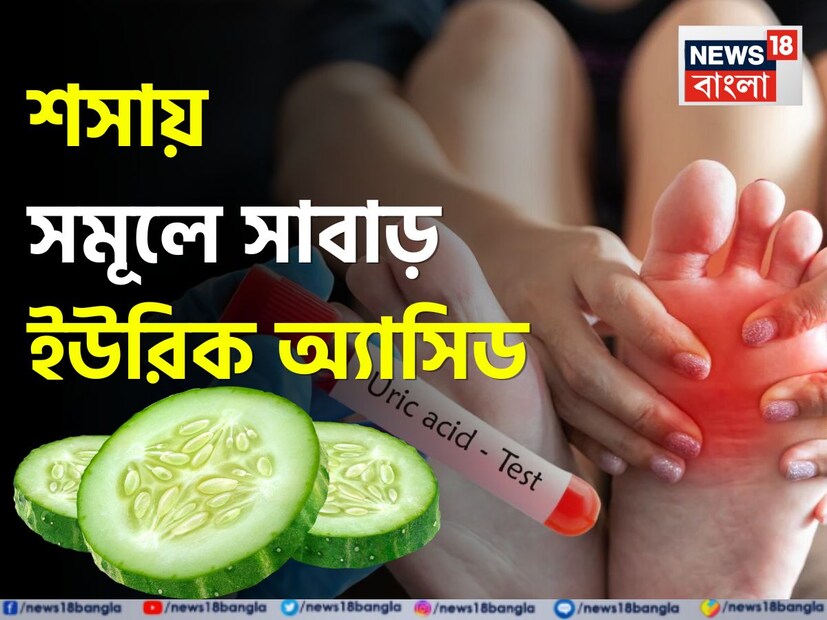 ইউরিক অ্যাসিড: ভুল অভ্যাস এবং জীবনযাত্রার পরিবর্তনের কারণে আজকাল অনেকেই ইউরিক অ্যাসিডের সমস্যায় ভুগছেন। এর ফলে জয়েন্টে ব্যথা এবং গেঁটেবাতের মতো রোগ হয়। জয়েন্টে ফোলাভাবের পাশাপাশি পা এবং হাতের বুড়ো আঙুলে ফোলাভাব এবং ব্যথার মতো লক্ষণ দেখা যায়।