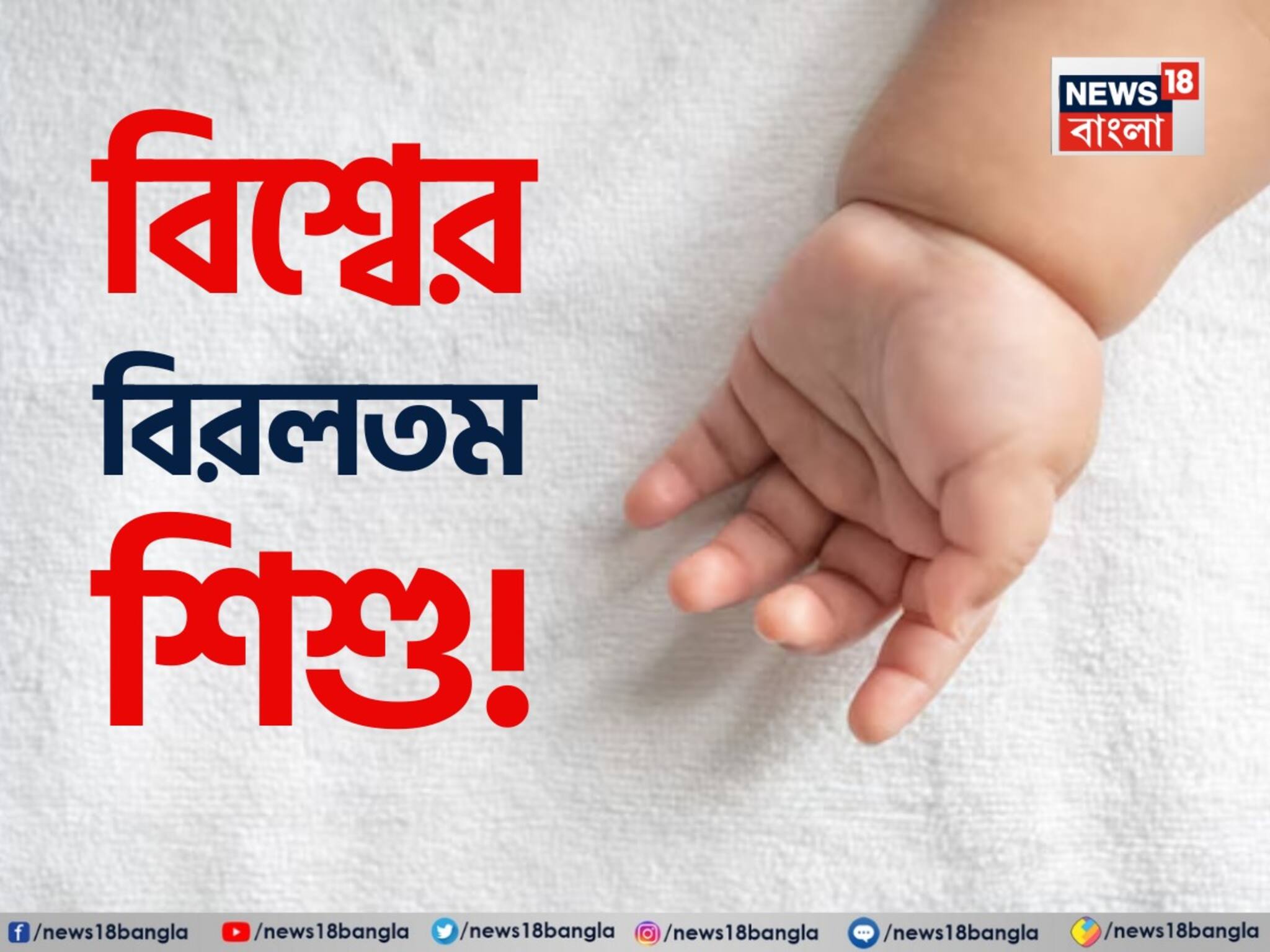 Viral: জন্ম নিল পৃথিবীর বিরলতম শিশু! দুটি মাথা, দুটি হৃদপিণ্ড... ভূমিষ্ঠ হওয়ার সঙ্গে সঙ্গেই চমকে গেল সবাই