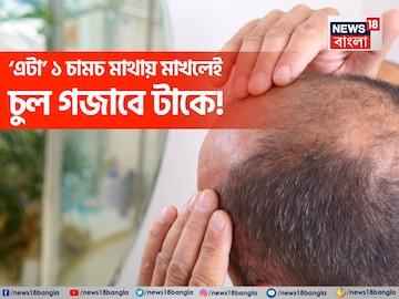 রান্নাঘরের মশলার কৌটো থেকে জাস্ট ১ চামচ নিয়ে এভাবে মাখুন মাথায়! চুল গজাবে টাকে রান্নাঘরের মশলার কৌটো থেকে জাস্ট ১ চামচ নিয়ে এভাবে মাখুন মাথায়! চুল গজাবে টাকে