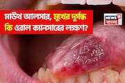 মাউথ আলসার, মুখে দীর্ঘস্থায়ী পচা দুর্গন্ধ থেকে কি ওরাল ক্যানসার হয়? জানুন এই রোগের লক্ষণ