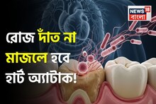 দাঁতের কালো গর্ত, পোকা খাওয়া দাঁত থেকে হতে পারে হার্ট অ্যাটাক! বাড়িয়ে দেয় স্ট্রোকের ঝুঁকি