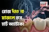 দাঁতের কালো গর্ত, পোকা খাওয়া দাঁত থেকে হতে পারে হার্ট অ্যাটাক! বাড়িয়ে দেয় স্ট্রোকের ঝুঁকি