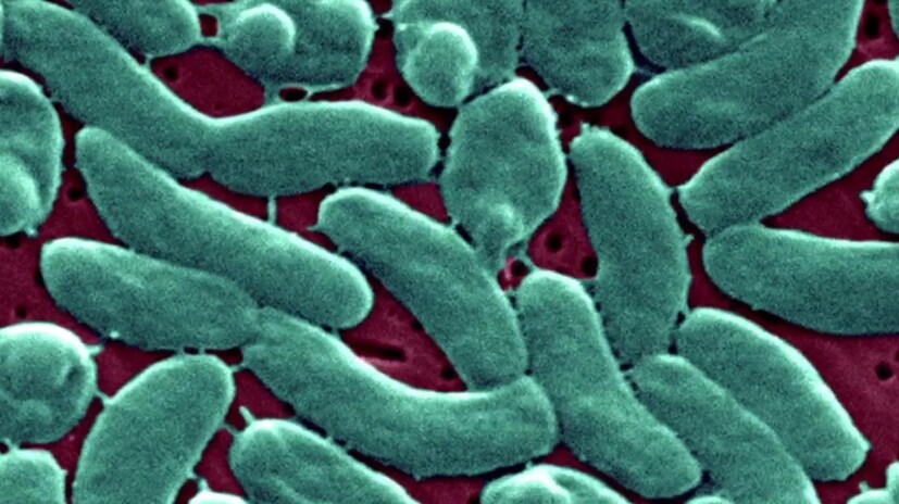 এই রোগটি কতটা বিপজ্জনক? যখন Vibrio vulnificus ব্যাকটেরিয়া শরীরে প্রবেশ করে, তখন এটি নেক্রোটাইজিং ফ্যাসাইটিস নামক একটি গুরুতর রোগের কারণ হতে পারে। এর ফলে সংক্রামিত এলাকার ত্বক মারা যেতে পারে। যদি রোগটি বিপজ্জনক হয়ে ওঠে, তাহলে এই ধরনের ক্ষেত্রে, বড় অস্ত্রোপচার বা এমনকি অঙ্গ কেটে ফেলার প্রয়োজন হতে পারে।
